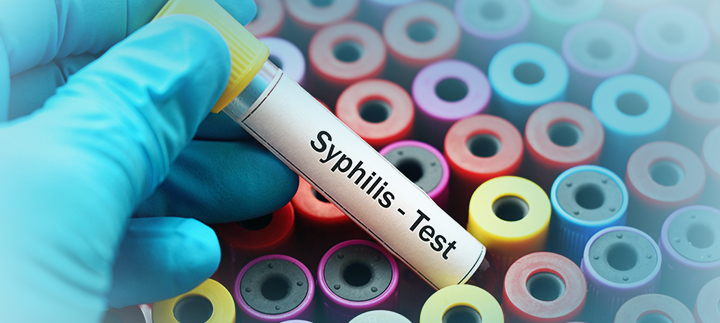 Syphilis Can Be Treated If Blood Test is Done Early