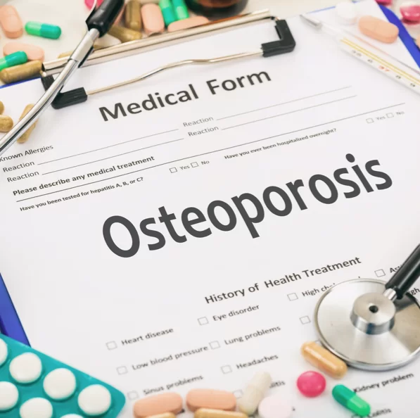 medical form of osteoporosis