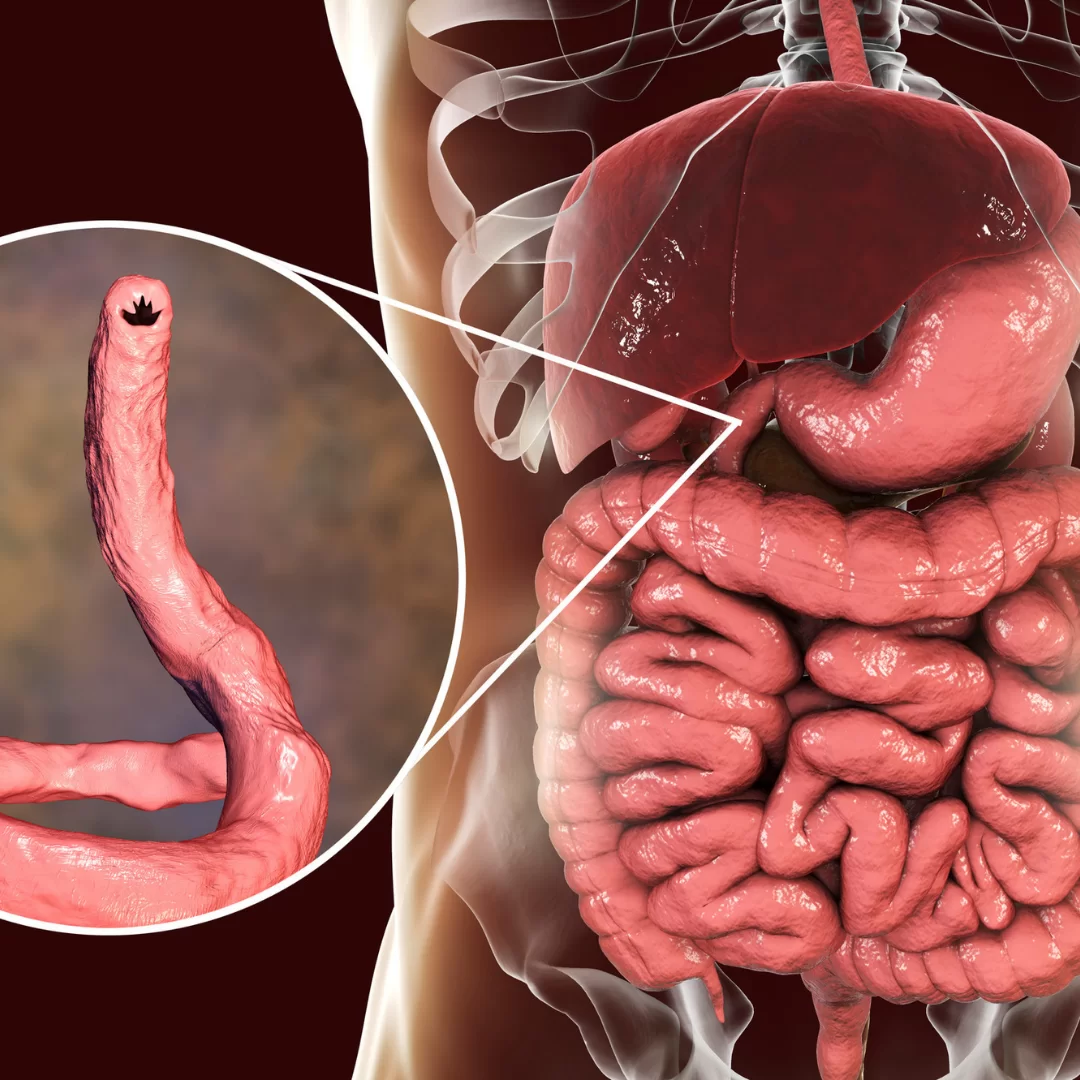 hookworms in humans symptoms