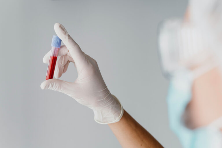 What Does It Mean If Your MCV Blood Test Is High? Personalabs