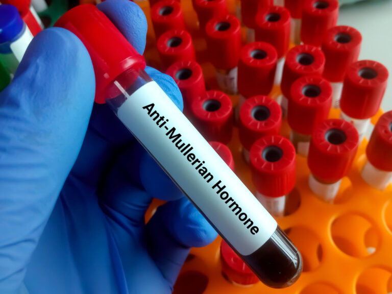 Amh Lab Everything You Need To Know About the Anti-Mullerian Hormone Test for ...
