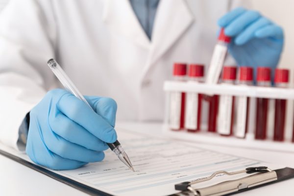 Platelet (plt) Blood Test: What High And Low Platelet Count Means