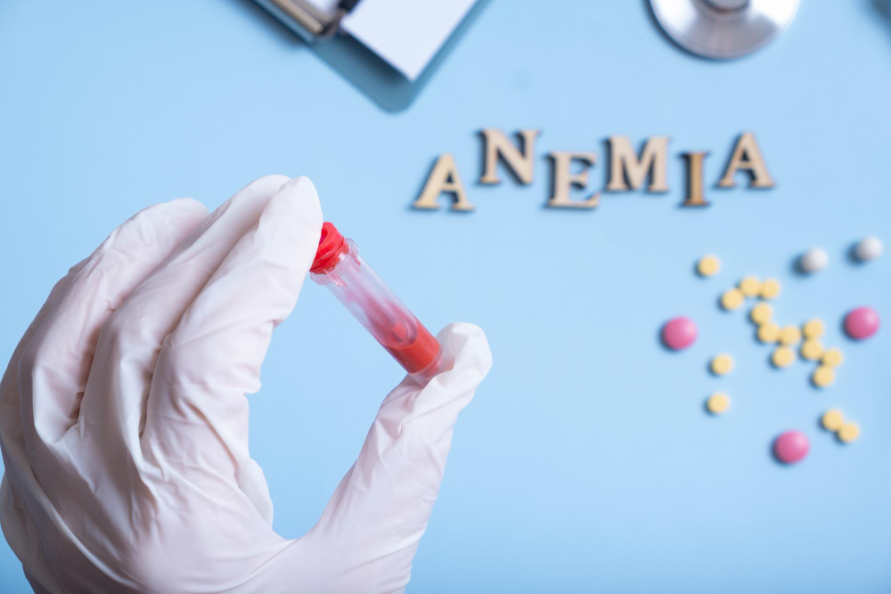 Container with blood analysis in gloved hand and anemia text with cstethoscope pills