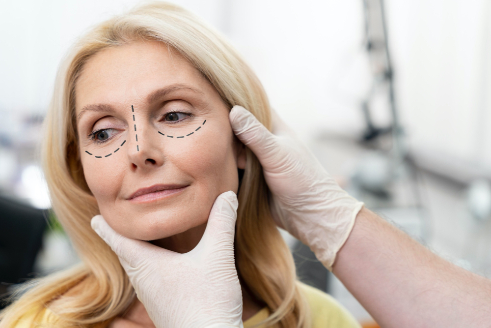 Woman getting ready for nose job surgery